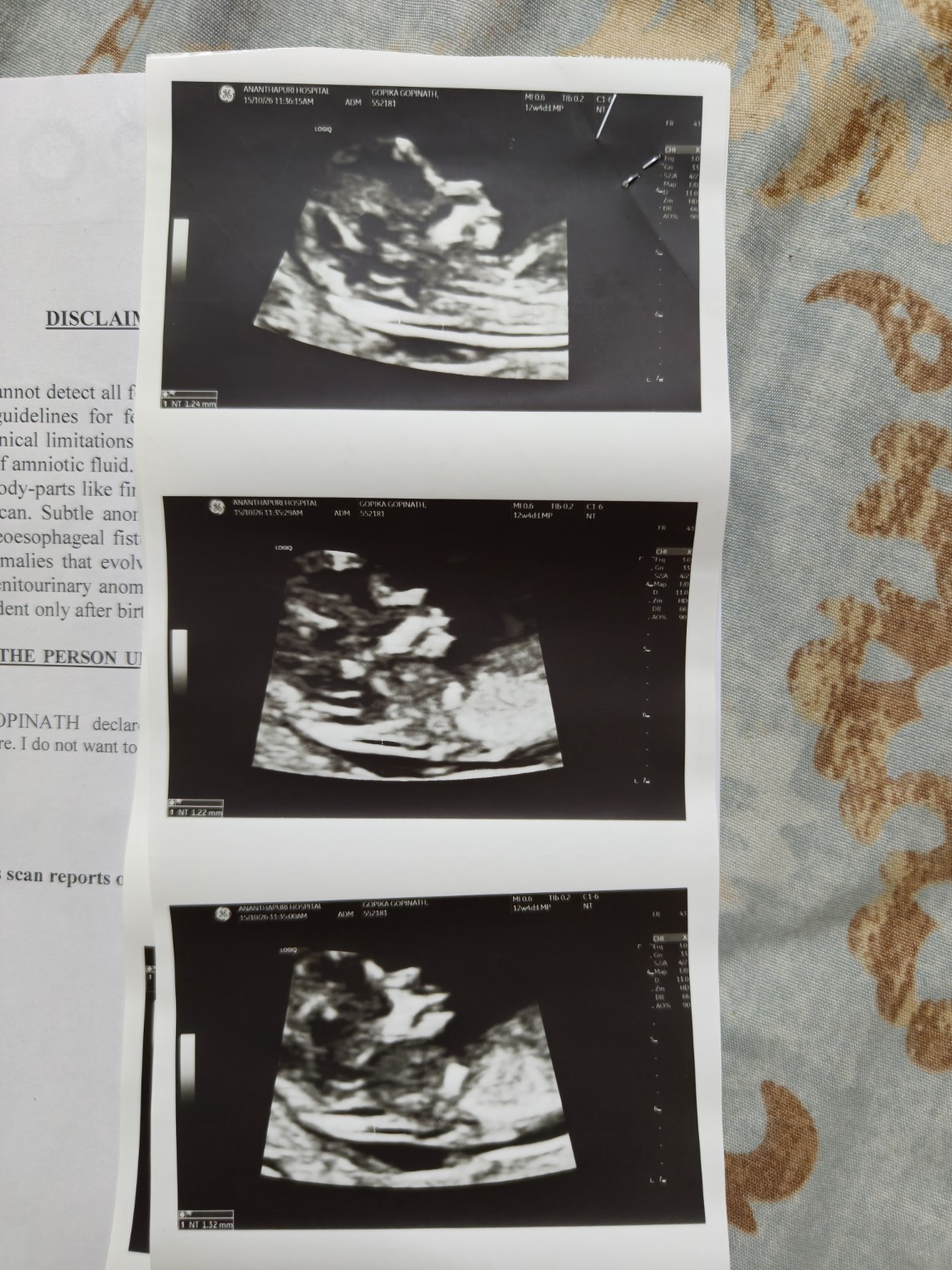 Complete original photograph of three ultrasound portraits
