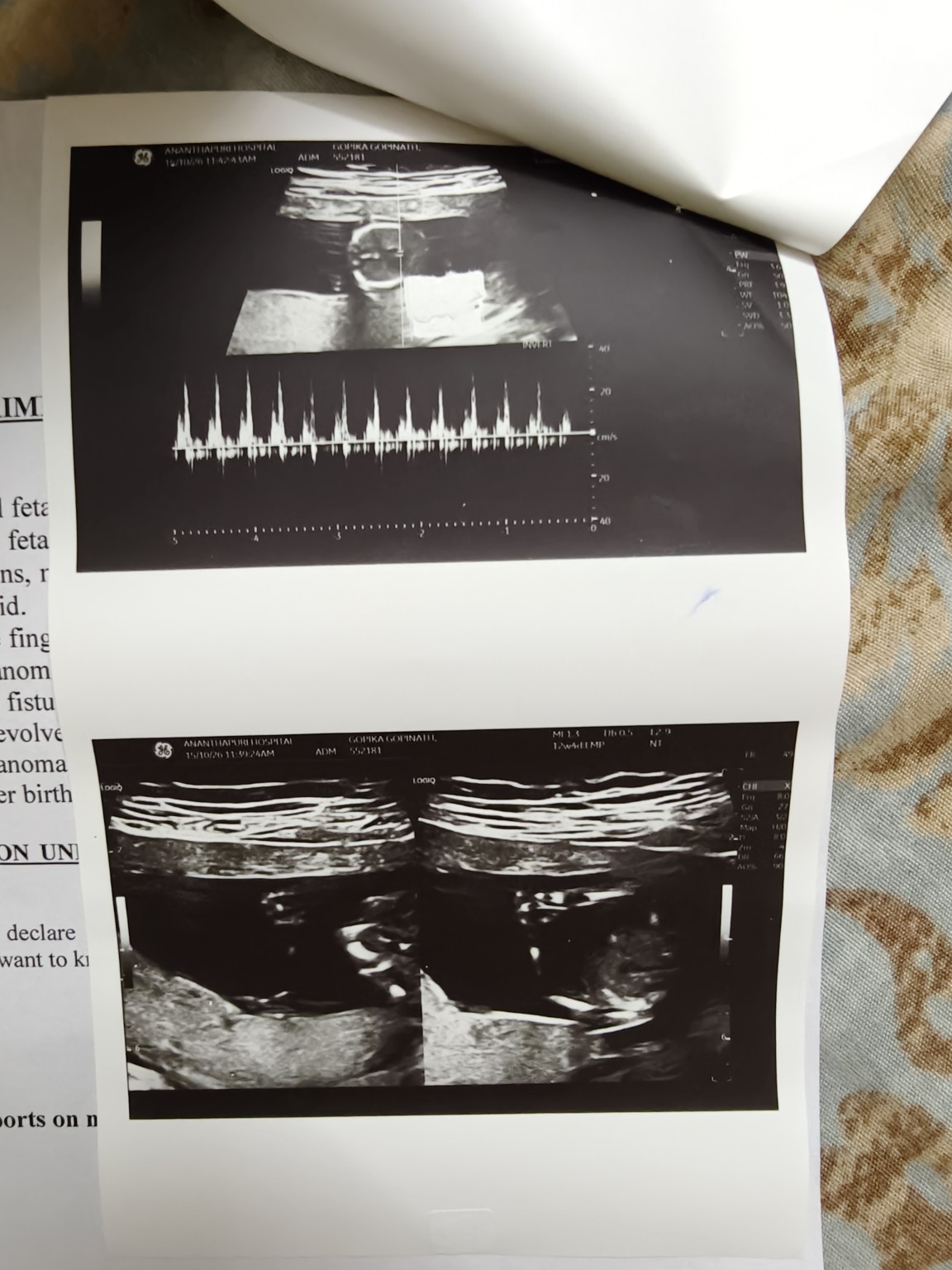 Complete original ultrasound photograph with a heartbeat trace